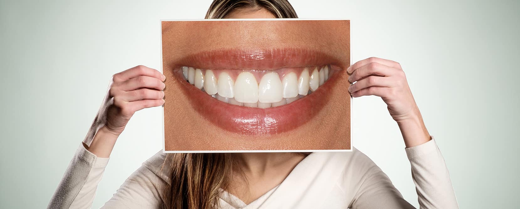 facettes dentaires cosmétiques -dental veneers cosmetic